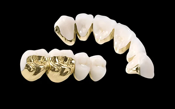 Răng sứ Bán quý