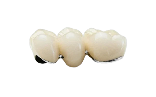 Răng Sứ Chrome Cobalt/ Full Chrome Cobalt