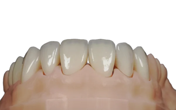Sứ Zirconia