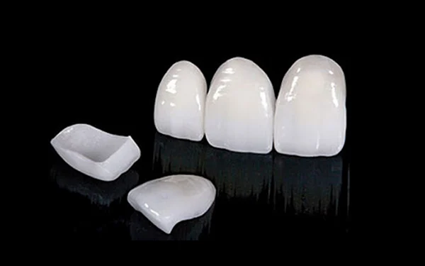 Mặt dán sứ Emax