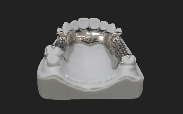 Hàm khung kim loại