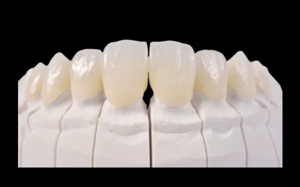 Hybrid sứ Zirconia